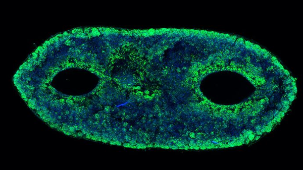 1729500880 397 Limpression 3D pour les patientes atteintes dun cancer du sein