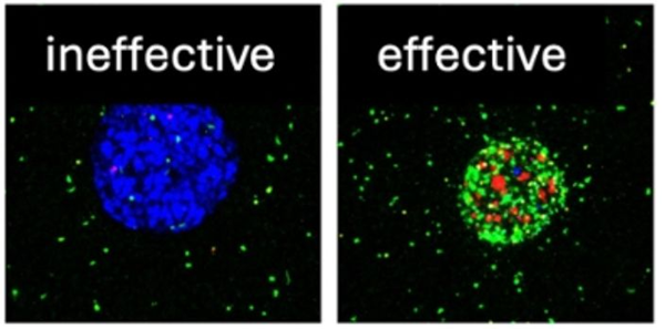 1729500881 471 Limpression 3D pour les patientes atteintes dun cancer du sein