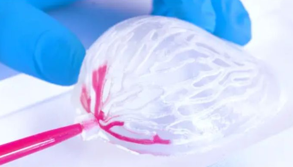 1729500881 639 Limpression 3D pour les patientes atteintes dun cancer du sein