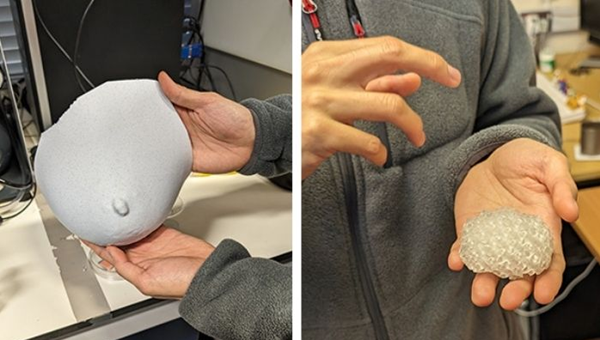 1729500881 663 Limpression 3D pour les patientes atteintes dun cancer du sein
