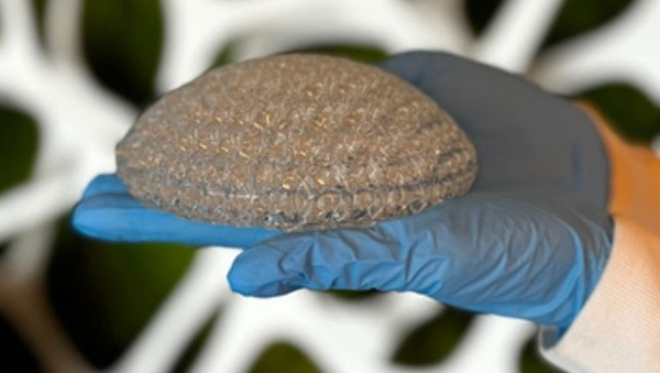 L'impression 3D pour les patientes atteintes d'un cancer du sein