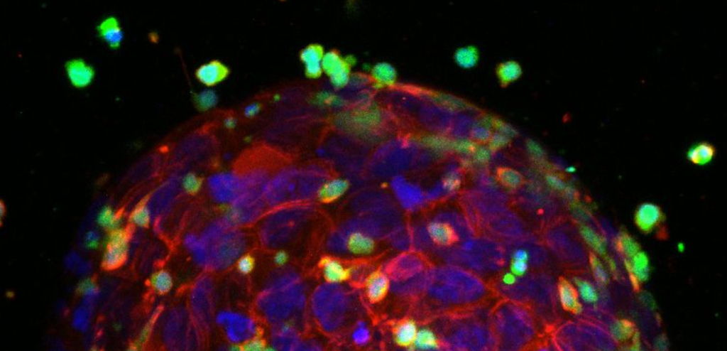Researchers use 3D printing technology to print tumors to advance cancer immunotherapy