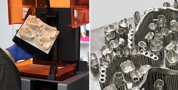 1729599141 628 Dental 3D printing Why will 3D technology revolutionize the industry