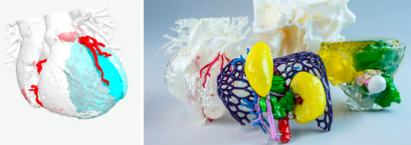 1731525017 522 3D printing patient specific medical models becomes easier