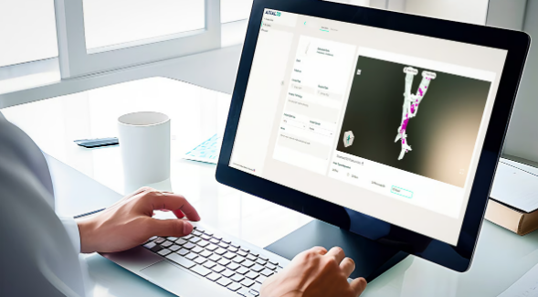 1731525018 565 3D printing patient specific medical models becomes easier