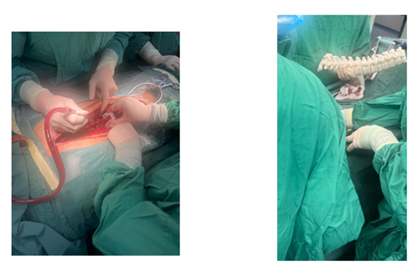 1731721113 923 Application of 3D printing to spine surgery