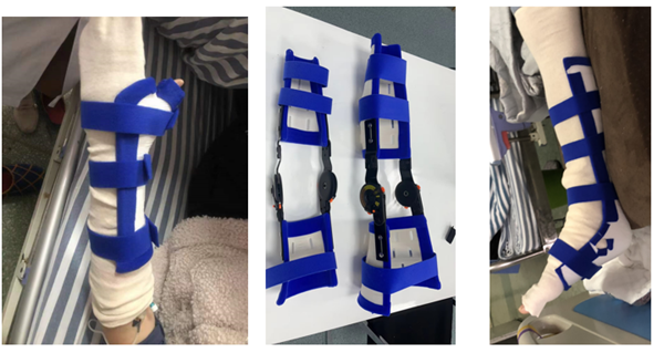 1731721114 78 Application of 3D printing to spine surgery