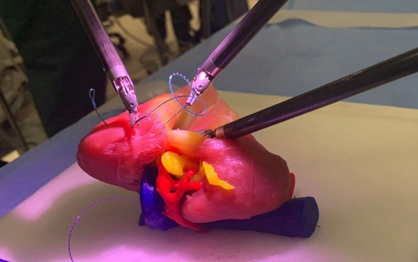 1731760523 485 IVIVAs 3D Printed Artificial Kidney Wins KidneyX Award Creating a New