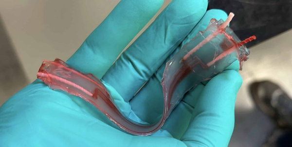 1731760523 90 IVIVAs 3D Printed Artificial Kidney Wins KidneyX Award Creating a New