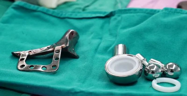 1732252185 960 3D printing reverse shoulder replacement solves the problem of patients