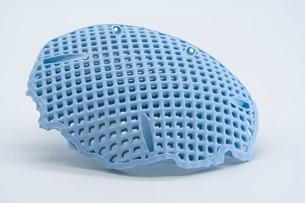 1732271221 124 Challenges and revolutionary medical applications of 3D printed ceramics