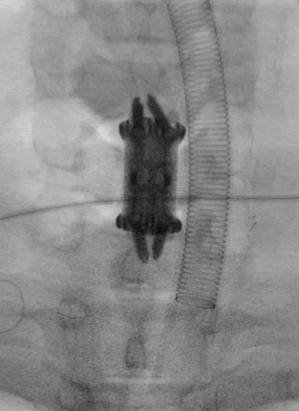 1732298136 557 Orthopedic applications of 3D printing have become common in the