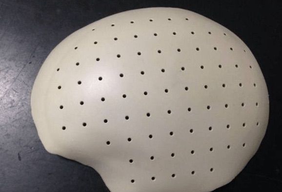 1732430347 401 Application of 3D PEEK in skull defects