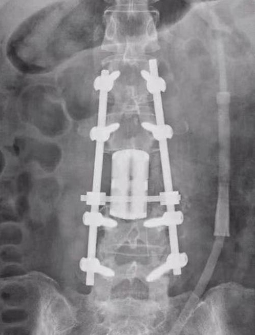 the third clinical college of xinjiang medical university carried out