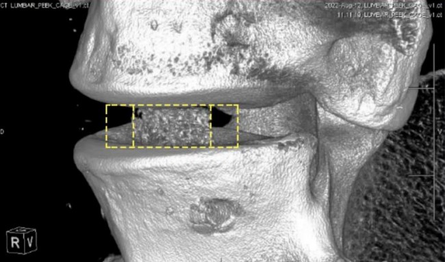 1732642432 298 Review of New Development Trend of Hard Tissue Implants from