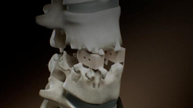 review of new development trend of hard tissue implants from