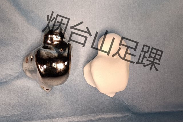 1732665514 650 The Foot and Ankle Surgery Department of Yantaishan Hospital performed