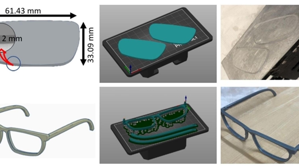 1732986834 836 UAE uses 3D printing technology to reconstruct patients eye socket