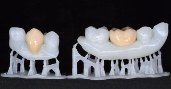 1733009148 346 Inventory Eight major applications of 3D printing in the dental