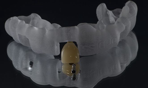 1733009148 61 Inventory Eight major applications of 3D printing in the dental