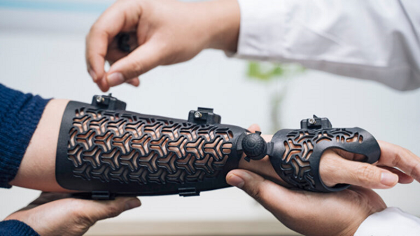 3D Printing in Healthcare Forecast 2023