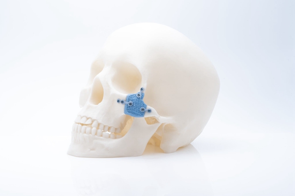 Challenges and revolutionary medical applications of 3D printed ceramics