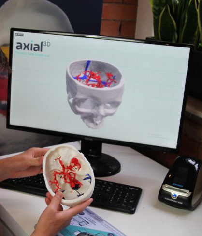 Online Anatomical Model 3D Printing Service Launched Overseas To Provide Online Anatomical Model 3D Printing Service Launched Overseas to Provide