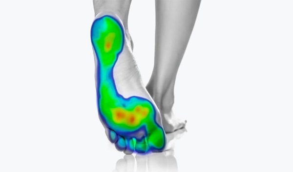 Queensland University of Technology 3D printed insole project helps prevent