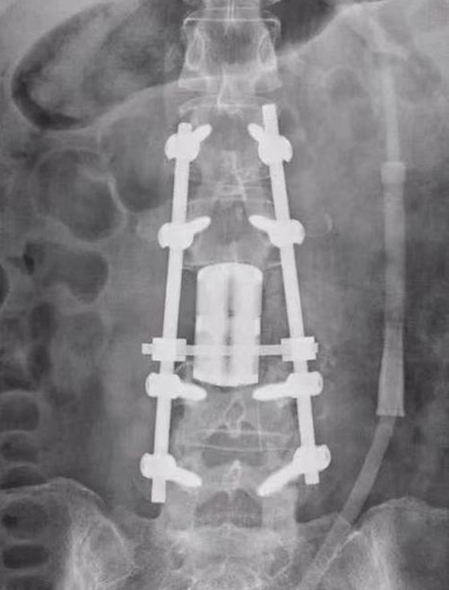 The Third Clinical College of Xinjiang Medical University carried out