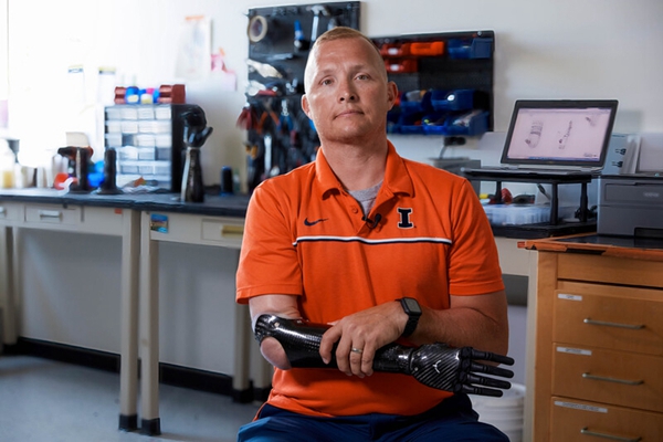 1733116227 425 High end customization 3D printed multi contact bionic functional arm