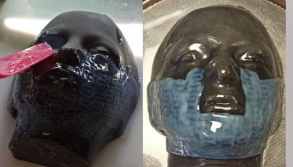 1733221315 45 3D printing used to treat seriously burned children