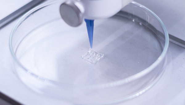 3D printed femur makes orthopedic surgery more precise