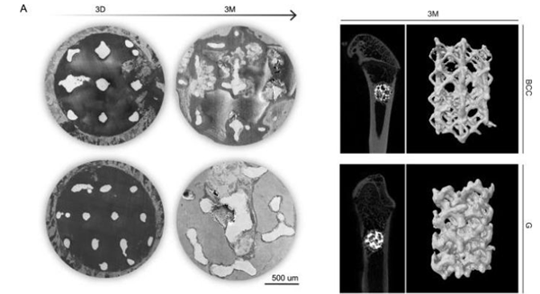 3D printed zinc scaffold could solve bone defects problem