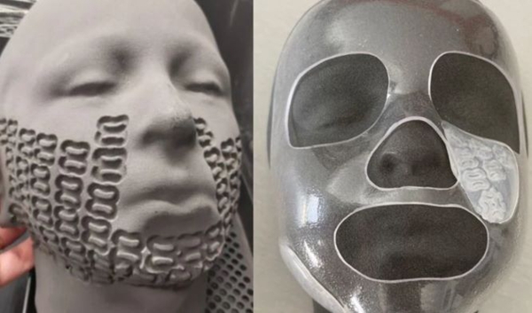 3D printing used to treat seriously burned children