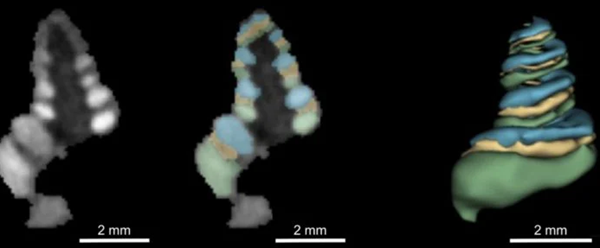 First 3D printed microneedles to treat hearing loss