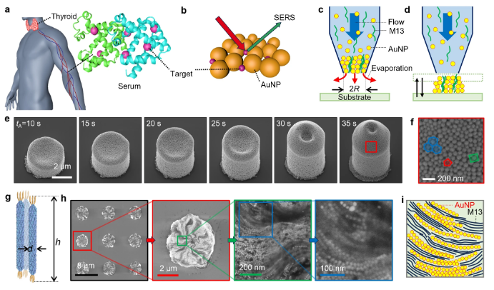 3D printed nanoclusters and AI cooperate jointly with serum thyroid cancer detection to open a new path for a non -invasive diagnosis